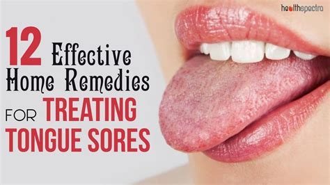 10 Bruise Under Tongue Remedies For Fast Healing