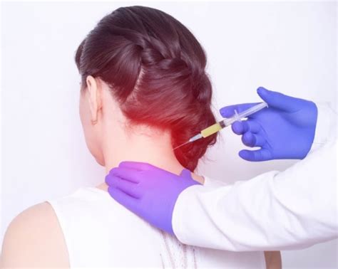 10+ Cervical Epidural Injection Tips For Less Pain