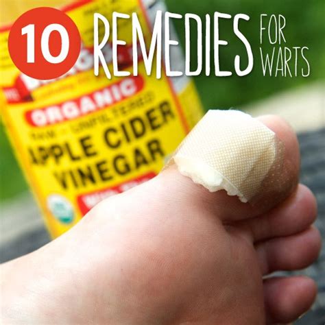 10 Common Remedies To Get Rid Of Warts Everyday Roots