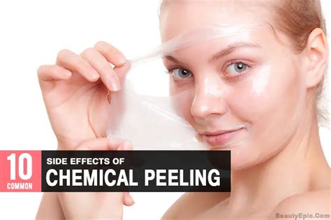 10 Common Side Effects Of Chemical Peeling