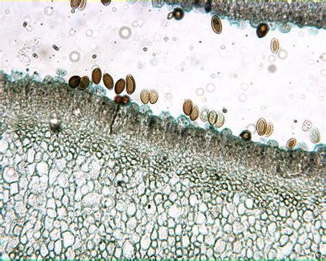 10 Coprinus Hyphae Insights Under Microscope