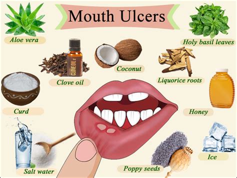 10 Heal Cut Mouth Remedies For Fast Relief