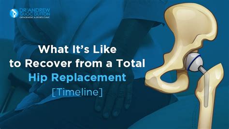 10 Hip Replacement Tips For Faster Recovery