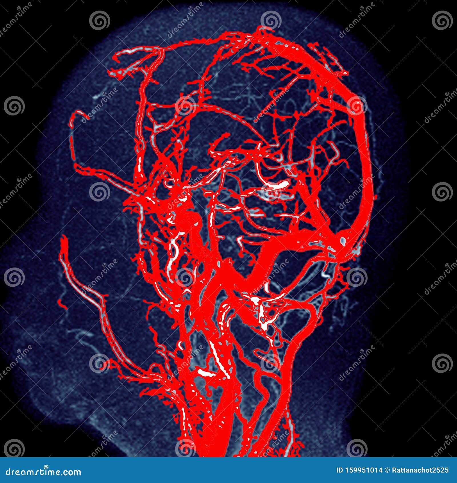 10 Mra Head Tips For Better Diagnosis