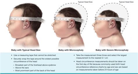 10 Neonatal Head Circumference Tips For Healthy Babies