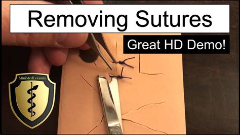 10+ Suture Removal Secrets For Less Scarring