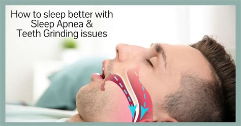 10 Teeth Grinding Solutions For Better Sleep