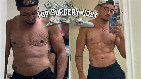 10 Top Surgery Costs Revealed