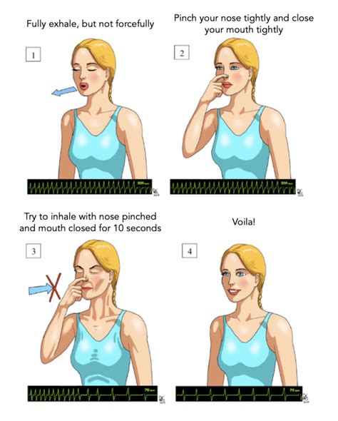 10 Vagal Maneuvers For Svt Relief