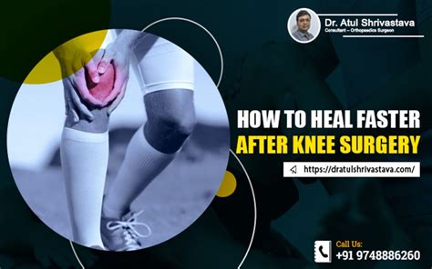 12+ Arthroscopic Knee Secrets Faster Healing