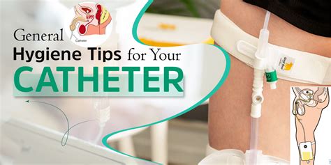 12+ At Home Catheter Secrets For Comfort