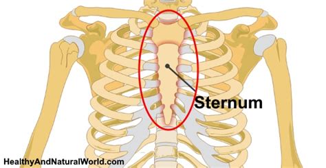 12+ Broken Sternum Remedies For Reduced Pain