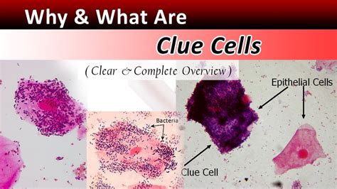 12 Clue Cells Wet Prep Tips For Accurate Diagnosis