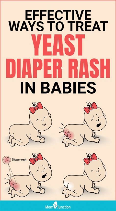 12 Effective Ways To Treat Diaper Rashes In Babies Artofit