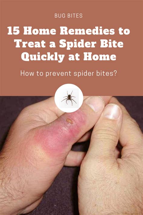 12 Grass Spider Bite Remedies For Quick Relief