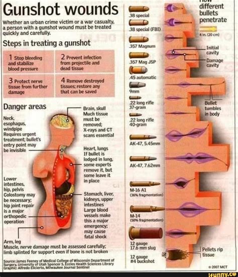 12 Gun Shot Wounds Facts To Save Lives