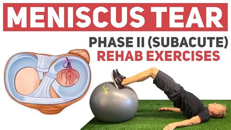 12 Meniscus Tear Rehab Tips For Faster Recovery