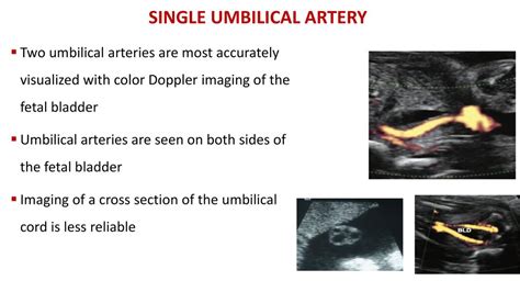 12+ One Umbilical Artery Symptoms To Know