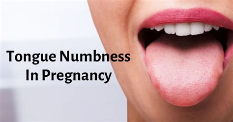 12 Pregnancy Numbness Fixes For Relief