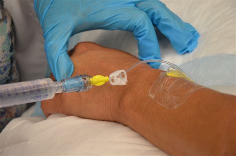 12 Saline Lock Iv Fluids Tips For Easy Management