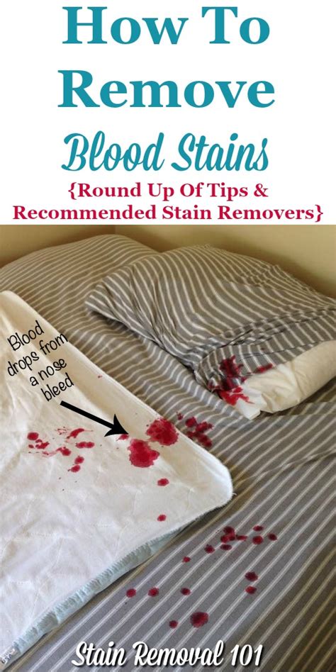 12+ Tricks To Remove Blood Stains Easily