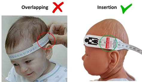 12+ Ways To Accurately Measure Neonatal Head Circumference