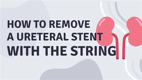 12+ Ways To Remove Ureter Stent With Minimal Pain