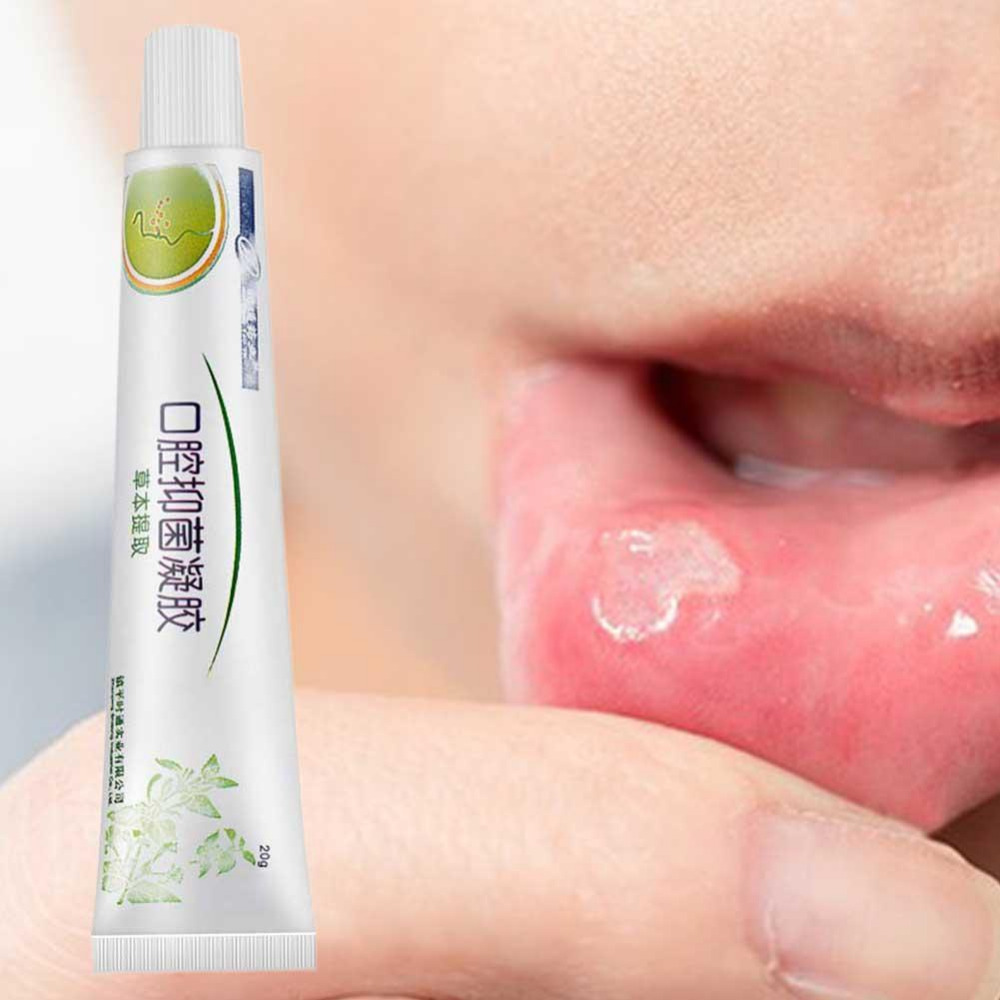 1Pcs Oral Care Mouth Ulcer Relief Gel Natural Herbal Oral Antibacterial