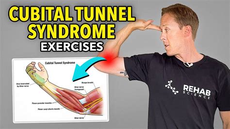 3 Exercises For Ulnar Nerve Entrapment Ulnar Nerve Entrapment Nerve