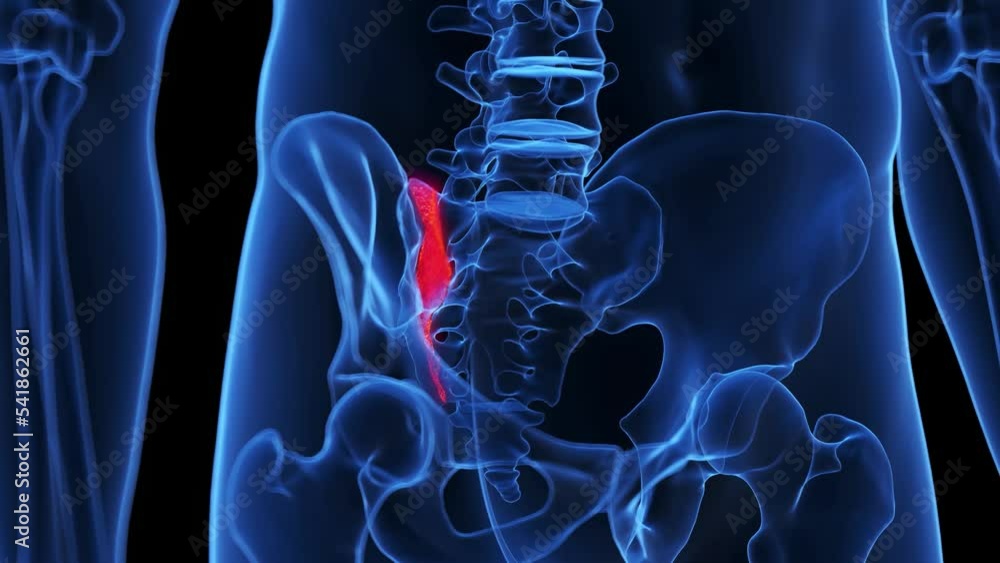 3D Rendered Medical Animation Of A Broken Sacrum Stock Video Adobe Stock