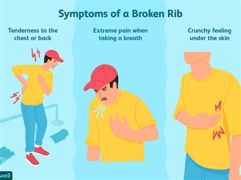 5 Tips On What To Do With Bruised Ribs Before Things Get Worse