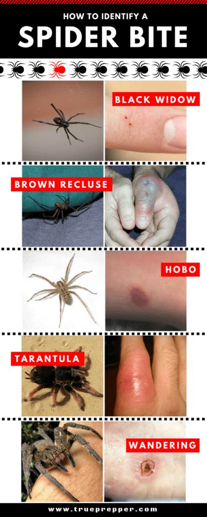 7 Grass Spider Bite Symptoms To Know Immediately