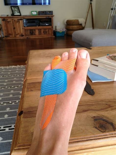 7+ Ways To Tape A Broken Toe For Less Pain