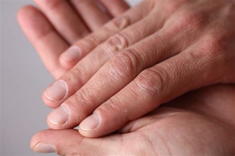 9 Causes Of Tingling Hands