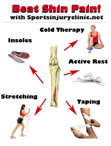 A Wellness Approach To Treating Shin Splints With Caution Shin