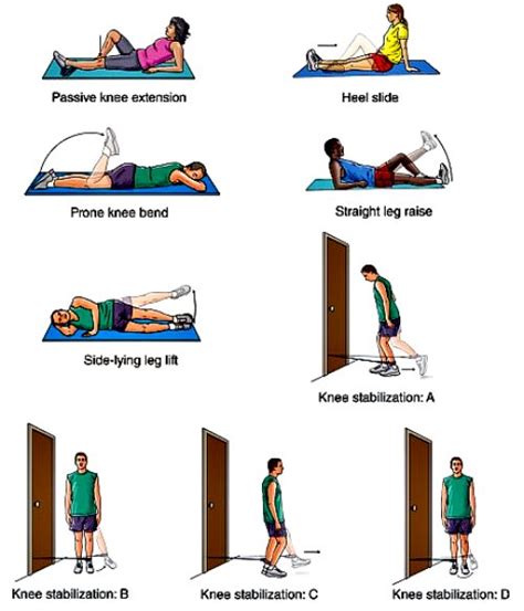 Acl Rehabilitation Exercises: Full Recovery