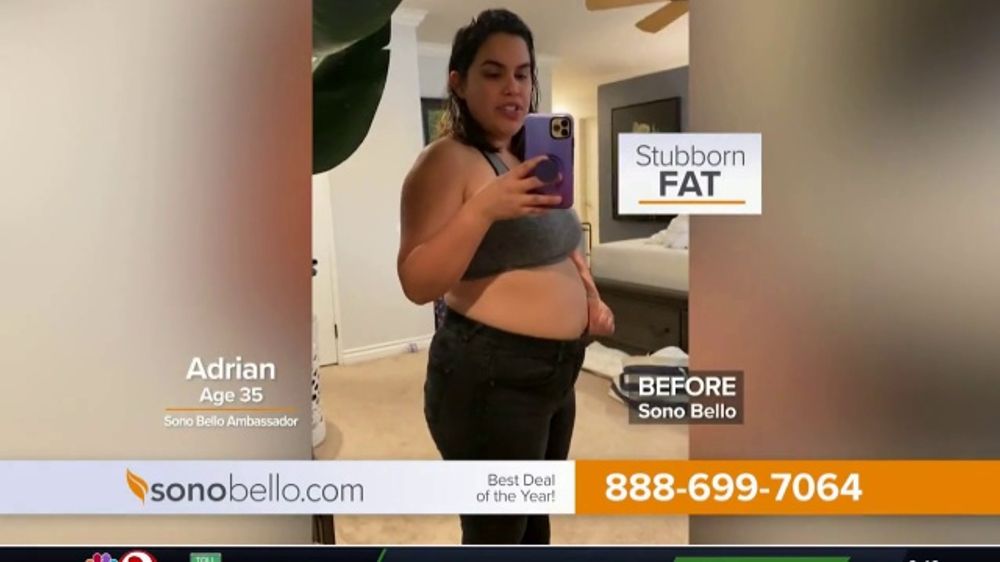 Aimee Reviews Her Abex Journey With Sono Bello Tummy Tuck Alternative