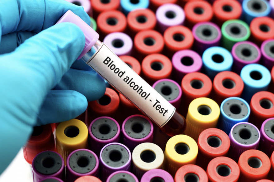 Alcohol Blood Testing Traditional Vs Peth Testing Dna Legal