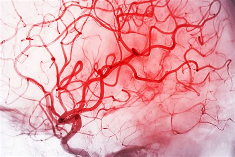 Angiogram Risk Of Death