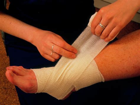 Applying Bandage To Sprained Ankle 2 Photograph By Hattie Young