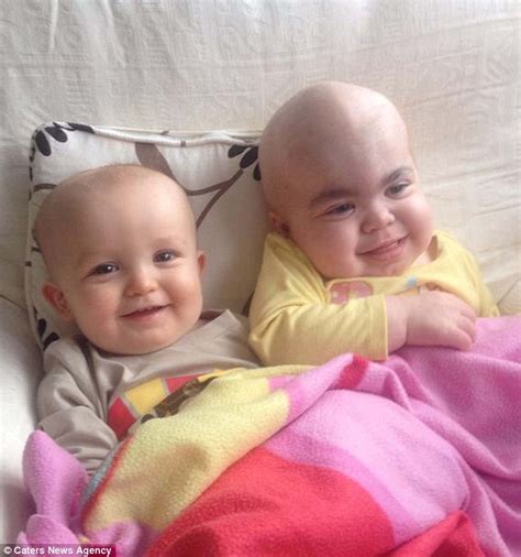 Baby Brother Donates Bone Marrow For Sister S Rare Debilitating