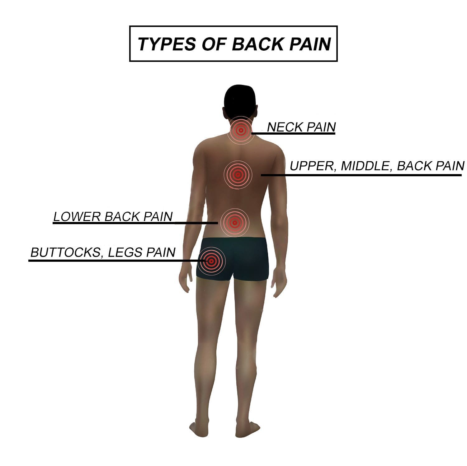 Back Pain Center Upper Mid Lower Back