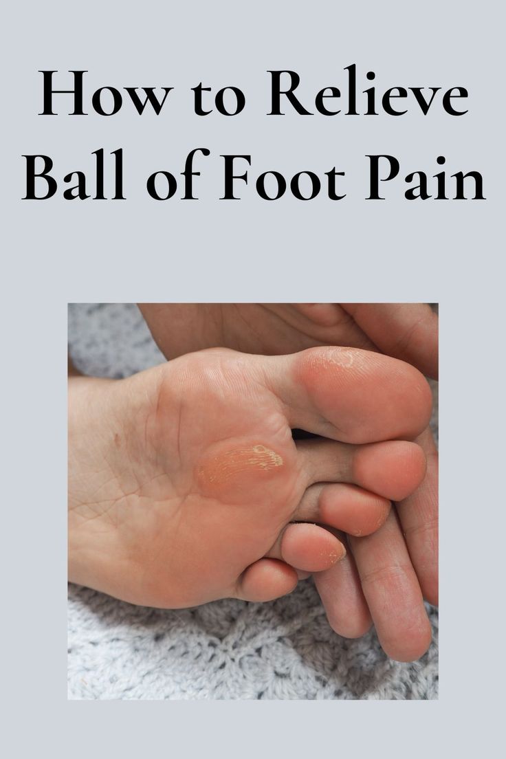 Ball Of The Foot: Relieve Pain Now