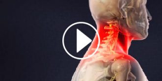 Benefits Of Epidural Steroid Injection In The Cervical Spine Pain