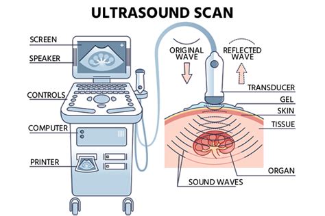 Best Usg Or Ultrasound Scan Cost Medicover Hospitals