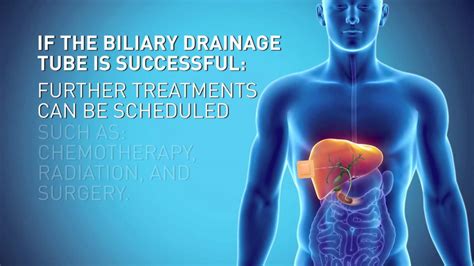 Biliary Drain Youtube