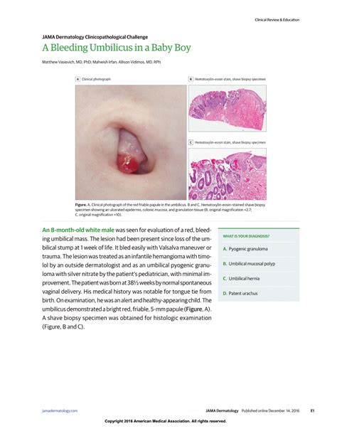 Bleeding Umbilicus Bump Dermatology Jama Dermatology The Jama Network