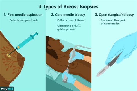 Breast Biopsy: Ease Tenderness Now