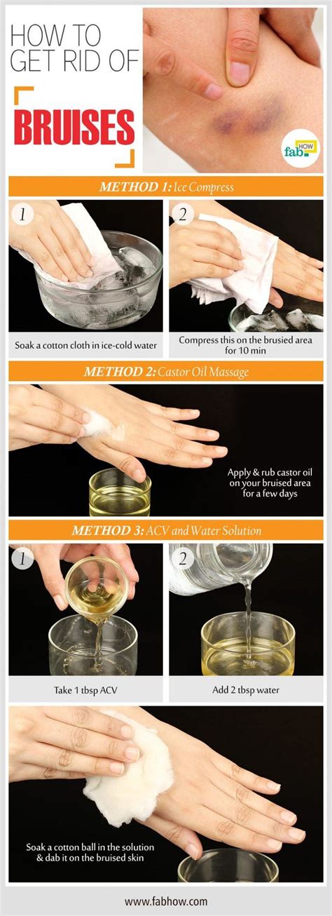 Bruised Finger Treatment: Heal Quickly