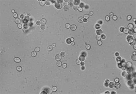 Budding Yeast Wet Mount